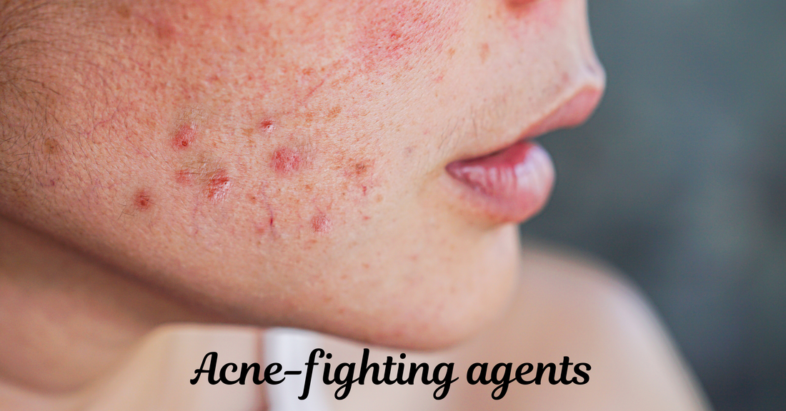 Acne-fighting agents